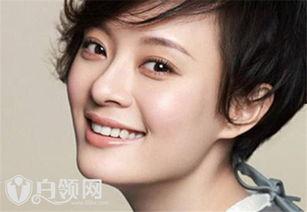 嘴角有痣明星,揭秘那些痣痣生辉的明星风采”